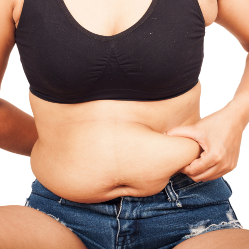 What is the difference between overweight belly, beerbelly, and the belly loosened after pregnancy (1)